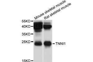 Western blot analysis of extracts of mouse skeletal muscle and rat skeletal muscel cells, using TNNI1 antibody.