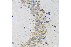 Immunohistochemistry of paraffin-embedded rat brain using CDK1 antibody. (CDK1 antibody  (AA 208-258))