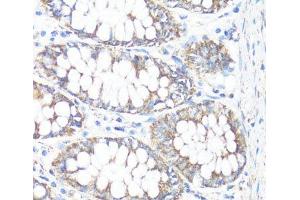 Immunohistochemistry (Paraffin-embedded Sections) (IHC (p)) image for anti-Hydroxysteroid (17-Beta) Dehydrogenase 10 (HSD17B10) antibody (ABIN7261405)