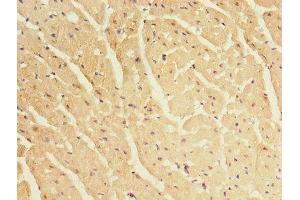 Immunohistochemistry of paraffin-embedded human heart tissue using ABIN7145462 at dilution of 1:100 (CRYBA1 antibody  (AA 1-215))