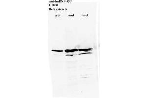 Image no. 2 for anti-Heterogeneous Nuclear Ribonucleoprotein K (HNRNPK) antibody (ABIN108575) (HNRNPK antibody)