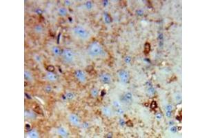 Used in DAB staining on fromalin fixed paraffin-embedded Brain tissue (Growth Hormone 1 antibody  (AA 28-217))