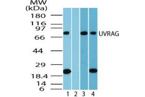 Image no. 1 for anti-UV Radiation Resistance Associated Gene (UVRAG) (AA 375-425) antibody (ABIN960401)