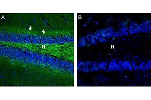 Expression of Neurofascin in mouse hippocampus. (NFASC antibody  (C-Term, Intracellular))