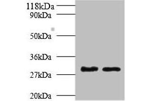 Western blot All lanes: Tpsb2 antibody at 2 μg/mL Lane 1: Mouse heart tissue Lane 2: Rat heart tissue Secondary Goat polyclonal to rabbit IgG at 1/10000 dilution Predicted band size: 31, 26 kDa Observed band size: 31 kDa (TPSB2 antibody  (AA 32-276))