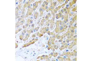 Immunohistochemistry of paraffin-embedded human liver using CCL8 antibody (ABIN5975074) at dilution of 1/100 (40x lens). (CCL8 antibody)