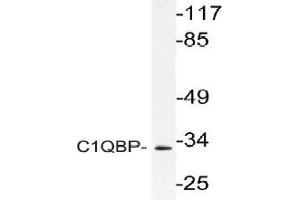 Western blot (WB) analysis of C1QBP antibody in extracts from Jurkat cells.
