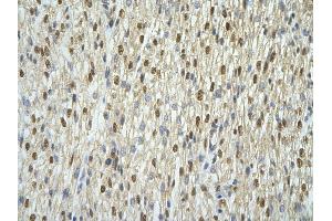 Immunohistochemistry (IHC) image for anti-Acidic (Leucine-Rich) Nuclear phosphoprotein 32 Family, Member A (ANP32A) (Middle Region) antibody (ABIN2778667)