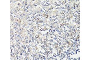 Immunohistochemistry of paraffin-embedded Human tonsil using MUL1 Polyclonal Antibody at dilution of 1:100 (40x lens). (MUL1 antibody)
