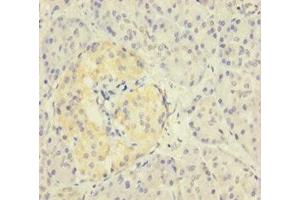 Immunohistochemistry of paraffin-embedded human pancreatic tissue using ABIN7176105 at dilution of 1:100 (ZNF114 antibody  (AA 1-414))