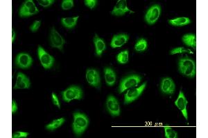 Immunofluorescence of monoclonal antibody to PAI-RBP1 on HeLa cell. (SERBP1 antibody  (AA 1-402))