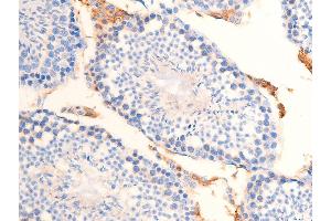 ABIN6267253 at 1/100 staining mouse testicular tissue sections by IHC-P. (CHEK2 antibody  (pThr68))
