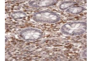 IHC staining of FFPE human small intestine lymphatic cells with S100A4 antibody at 2ug/ml. (s100a4 antibody)