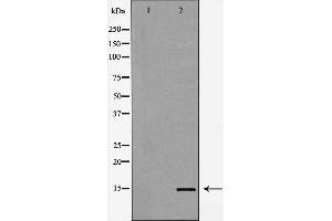 Western blot analysis of extracts of HeLa, using H3K14me1 antibody. (Histone 3 antibody  (H3K14me))