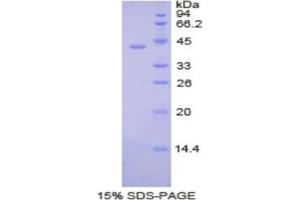 SDS-PAGE analysis of Human PDHa Protein. (PDHa Protein)