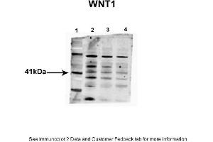 Sample Type: 1. (WNT1 antibody  (Middle Region))