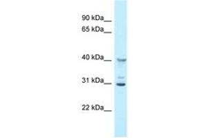 Image no. 1 for anti-2'-5' Oligoadenylate Synthetase 1G (OAS1G) (AA 60-109) antibody (ABIN6747816) (OAS1G antibody  (AA 60-109))