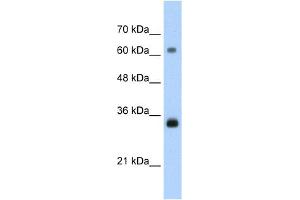 WB Suggested Anti-PCNA Antibody Titration:  1. (PCNA antibody  (C-Term))
