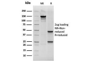 SDS-PAGE Analysis Purified CK19 Mouse Recombinant Monoclonal Antibody (rKRT19/800). (Recombinant Cytokeratin 19 antibody)