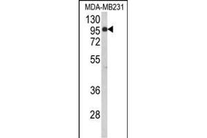 Western blot analysis of BAHD1 Antibody (C-term) (ABIN653104 and ABIN2842693) in MDA-M cell line lysates (35 μg/lane). (BAHD1 antibody  (C-Term))