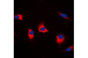 Immunofluorescent analysis of DFF45 staining in HeLa cells. (DFFA antibody  (Center))