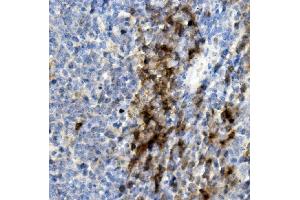 IHC analysis of CD8 alpha/Cd8a using anti-CD8 alpha/Cd8a antibody (ABIN7601570). (CD8 alpha antibody  (AA 39-245))