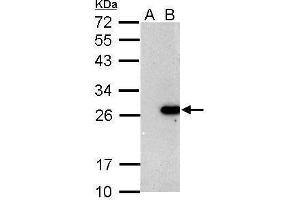 WB Image Sample (30 ug of whole cell lysate) A: Non-transfected 293T lysates B: BCL2 transfected 293T lysate 12% SDS PAGE antibody diluted at 1:5000 (Bcl-2 antibody)