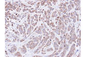 IHC-P Image Immunohistochemical analysis of paraffin-embedded MDA-MB-468 xenograft, using Cyclophilin A, antibody at 1:500 dilution. (PPIA antibody  (C-Term))