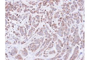 IHC-P Image Immunohistochemical analysis of paraffin-embedded MDA-MB-468 xenograft, using Cyclophilin A, antibody at 1:500 dilution. (PPIA antibody  (C-Term))
