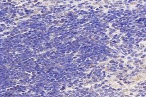 Immunohistochemistry analysis of paraffin-embedded mouse thymus using,PPIL2 (ABIN7075005) at dilution of 1: 3600 (PPIL2 antibody)