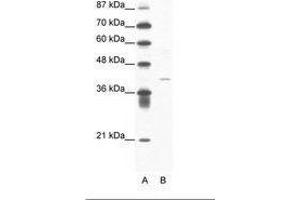 Image no. 1 for anti-Hypoxia Inducible Factor 1, alpha Subunit Inhibitor (HIF1AN) (N-Term) antibody (ABIN202309) (HIF1AN antibody  (N-Term))