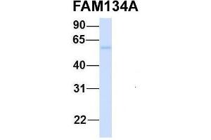 Host:  Rabbit  Target Name:  FAM134A  Sample Type:  Human Fetal Heart  Antibody Dilution:  1.