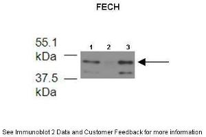 Lanes:   1. (FECH antibody  (N-Term))