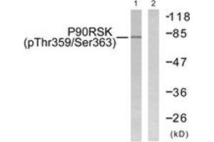 Western blot analysis of extracts from 293 cells treated with PMA 125ng/ml 30', using p90 RSK (Phospho-Thr359+Ser363) Antibody. (RPS6KA3 antibody  (pThr359))