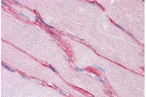 Human Skeletal Muscle: Formalin-Fixed, Paraffin-Embedded (FFPE) (SGCB antibody  (AA 87-197))
