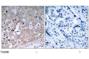 Image no. 1 for anti-VEGF Receptor 2 (VEGFR2) (Tyr1175) antibody (ABIN197237) (VEGFR2/CD309 antibody  (Tyr1175))