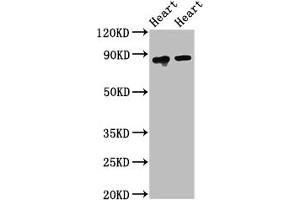 Western Blot Positive WB detected in: Rat heart tissue, Mouse heart tissue All lanes: ACO2 antibody at 2.