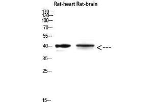 Western Blot (WB) analysis of Rat Heart and Rat Brain using Cerberus Polyclonal Antibody diluted at 1:500.