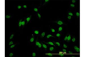 Immunofluorescence of monoclonal antibody to HEYL on HeLa cell. (HEYL antibody  (AA 221-327))