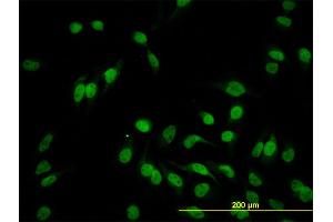 Immunofluorescence of monoclonal antibody to HEYL on HeLa cell. (HEYL antibody  (AA 221-327))