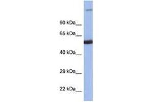 Image no. 1 for anti-Interferon Regulatory Factor 8 (IRF8) (C-Term) antibody (ABIN6747508) (IRF8 antibody  (C-Term))