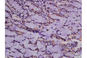 Immunohistochemistry (Paraffin-embedded Sections) (IHC (p)) image for anti-Chromosome 12 Open Reading Frame 44 (C12orf44) (AA 121-218) antibody (ABIN2559562)