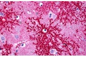 Anti-SLC1A2 / EAAT2 antibody IHC staining of human brain, astrocytes. (SLC1A2 antibody  (C-Term))
