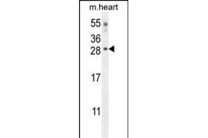 CLDN6 Antibody (Center) (ABIN654669 and ABIN2844365) western blot analysis in mouse heart tissue lysates (35 μg/lane). (Claudin 6 antibody  (AA 130-159))