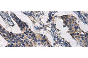 COL17A1 antibody