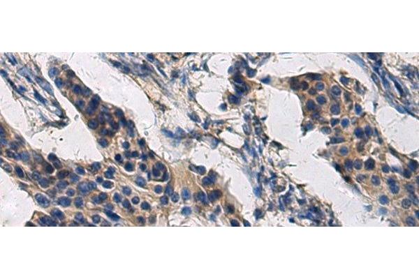 COL17A1 antibody