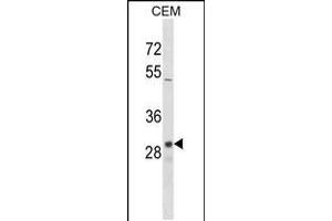 Western blot analysis in CEM cell line lysates (35ug/lane). (OR1D2 antibody  (C-Term))