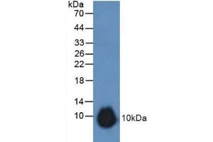 Detection of GREM1 in Rat Stomach Tissue using Polyclonal Antibody to Gremlin 1 (GREM1) (GREM1 antibody  (AA 25-184))