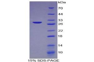 SDS-PAGE (SDS) image for Collagen, Type IV, alpha 2 (COL4A2) (AA 1487-1703) protein (His tag) (ABIN2124432)