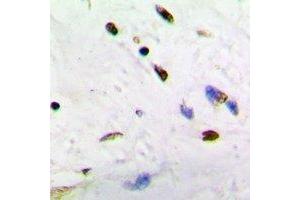 Immunohistochemical analysis of ADNP staining in human brain formalin fixed paraffin embedded tissue section. (ADNP antibody  (N-Term))